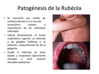 Patogénesis de la Rubéola
• Se transmite por medio de
contacto directo o a su vez por
nasales o
de los individuos
secreciones
respiratorias
infectados.
• Infecta directamente el tracto
respiratorio superior, se extiende
a los ganglios linfáticos y se
inflaman, especialmente los de la
garganta.
• Puede la infección de otros
tejidos y erupciones ligeramente
moradas a nivel cutáneo
llamadas exantemas
 