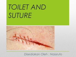 TOILET AND
SUTURE
Disediakan Oleh : Nassruto
 