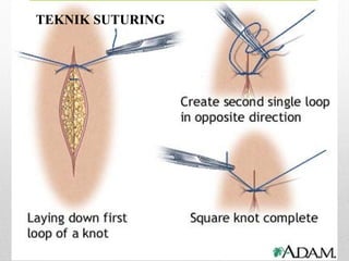 TEKNIK SUTURING
 