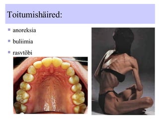 Toitumishäired: anoreksia buliimia rasvtõbi 