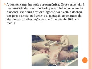  A doença também pode ser congênita. Neste caso, ela é
transmitida da mãe infectada para o bebê por meio da
placenta. Se a mulher foi diagnosticada com a doença
um pouco antes ou durante a gestação, as chances de
ela passar a inflamação para o filho são de 30%, em
média.
 