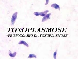 TOXOPLASMOSE
(PROTOZOÁRIO DA TOXOPLASMOSE)
 