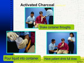 Activated Charcoal continued
Pour liquid into container. Have patient drink full dose.
Shake container throughly.
 