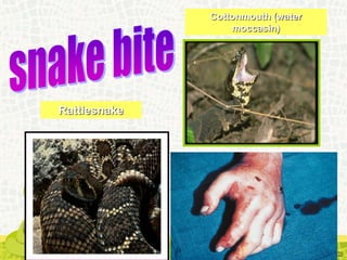 Rattlesnake
Cottonmouth (water
moccasin)
 