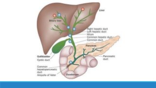 Khuyến cáo TOKYO 2018 - Chẩn đoán viêm túi mật cấp