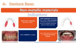 "
“ ”
Tooth-tissue supported
edentulous space”
“tooth supported edentulous
space where bone resorption
is expected increased rate of
bone loss (diabetic patients/
patients taking steroids)”
“When esthetics is needed”
“cases with extreme bone loss
>>> restore the normal
contour”
“Files.sld.cu. Available from: http://files.sld.cu/protesis/files/2018/06/chapter6denture-bases.pdf”
 