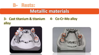 Titanium Base Rpd Materials used in RPD construction | PDF