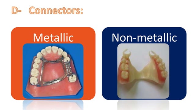 Materials used in RPD construction | PDF | Dental Health | Diseases and ...