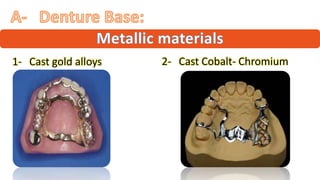 "
“ ”
1- Cast gold alloys 2- Cast Cobalt- Chromium
 