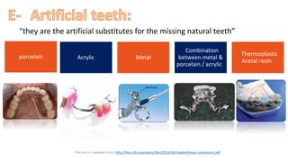 “they are the artificial substitutes for the missing natural teeth”
“ ”
“porcelain” “Acrylic” “Metal”
“Combination
between metal &
porcelain / acrylic”
“Thermoplastic
Acetal resin”
“Files.sld.cu. Available from: http://files.sld.cu/protesis/files/2018/06/chapter4major-connectors.pdf”
 