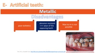 “ ”
“poor esthetics”
“abrasion resistant
>>> wear of the
opposing teeth”
“Wax try-in is not
possible”
“Files.sld.cu. Available from: http://files.sld.cu/protesis/files/2018/06/chapter4major-connectors.pdf”
 