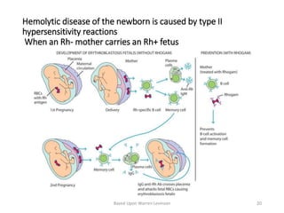 Hemolytic disease of the newborn is caused by type II
hypersensitivity reactions
When an Rh- mother carries an Rh+ fetus
Based Upon Warren Levinson 20
 