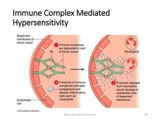 Immune Complex Mediated
Hypersensitivity
Based Upon Warren Levinson 28
 