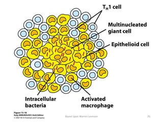 Based Upon Warren Levinson 35
 
