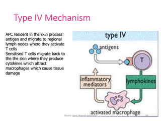Type IV Mechanism
APC resident in the skin process
antigen and migrate to regional
lymph nodes where they activate
T cells
Sensitised T cells migrate back to
the the skin where they produce
cytokines which attract
macrophages which cause tissue
damage
Based Upon Warren Levinson 43
 