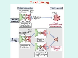 Tolerance & autoimmunity and organ specific autoimmune diseases | PPT