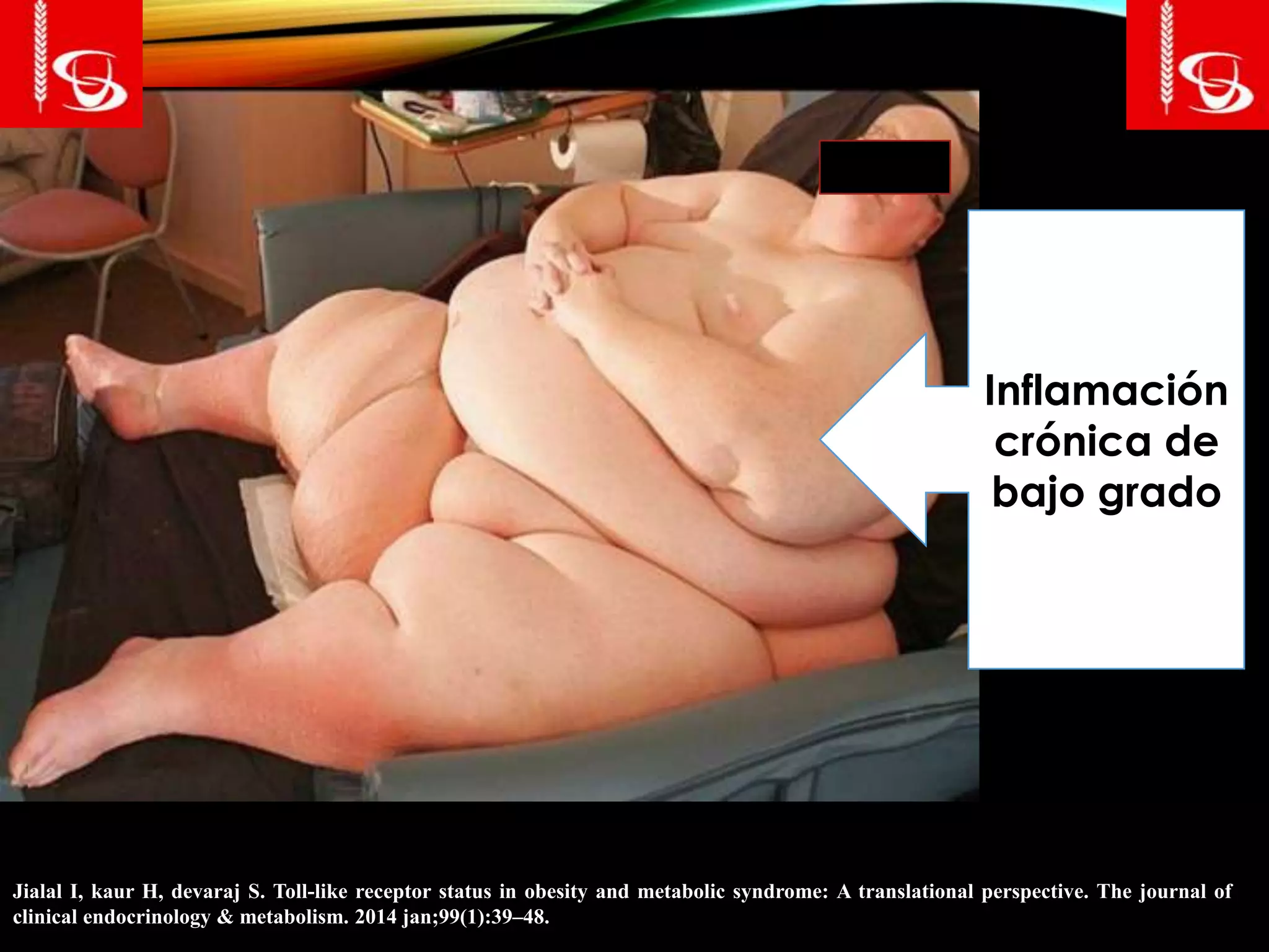 Inflamación
crónica de
bajo grado
Jialal I, kaur H, devaraj S. Toll-like receptor status in obesity and metabolic syndrome: A translational perspective. The journal of
clinical endocrinology & metabolism. 2014 jan;99(1):39–48.
 