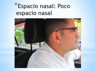 *Espacio nasal: Poco
espacio nasal
 