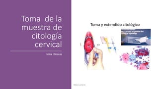 Toma de la
muestra de
citología
cervical
Irma Illescas
IRMA ILLESCAS
 