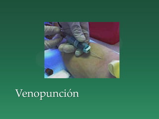 Venopunción
 