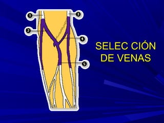 SELEC CIÓNSELEC CIÓN
DE VENASDE VENAS
 