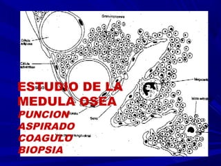 ESTUDIO DE LA
MEDULA OSEA
PUNCION
ASPIRADO
COAGULO
BIOPSIA
 