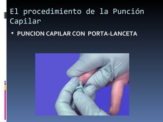 El procedimiento de la Punción Capilar PUNCION CAPILAR CON  PORTA-LANCETA 