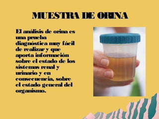 MUESTRA DE ORINAMUESTRA DE ORINA
El análisis de orina esEl análisis de orina es
una pruebauna prueba
diagnóstica muy fácildiagnóstica muy fácil
de realizary quede realizary que
aporta informaciónaporta información
sobre el estado de lossobre el estado de los
sistemas renal ysistemas renal y
urinario y enurinario y en
consecuencia, sobreconsecuencia, sobre
el estado general delel estado general del
organismo.organismo.
 