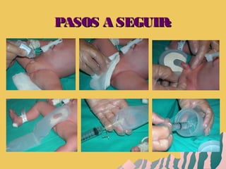 PASOS A SEGUIR:PASOS A SEGUIR:
 