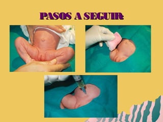 PASOS A SEGUIR:PASOS A SEGUIR:
 