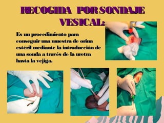 RECOGIDA PORSONDAJERECOGIDA PORSONDAJE
VESICAL:VESICAL:
Es un procedimiento paraEs un procedimiento para
conseguiruna muestra de orinaconseguiruna muestra de orina
estéril mediante la introducción deestéril mediante la introducción de
una sonda a través de la uretrauna sonda a través de la uretra
hasta la vejiga.hasta la vejiga.
 