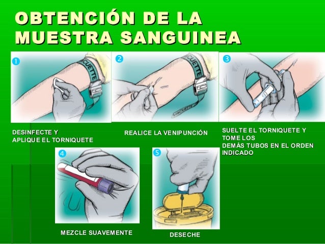 Toma de muestra sanguinea
