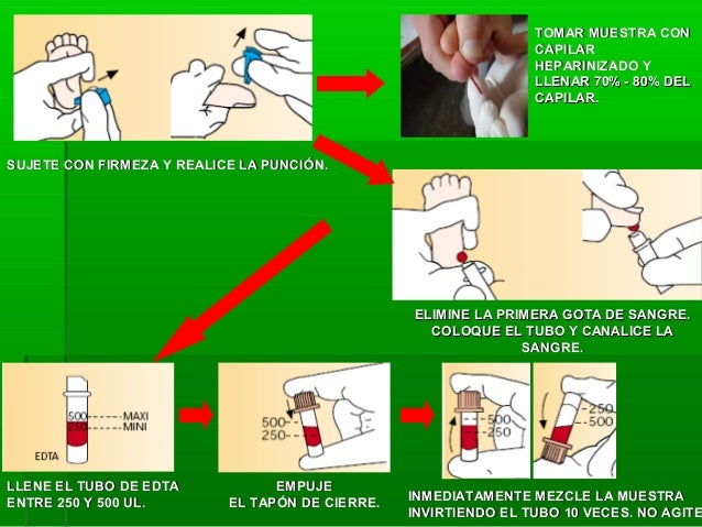 Toma de muestra sanguinea