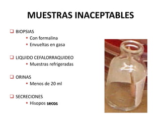 MUESTRAS INACEPTABLES
 BIOPSIAS
 Con formalina
 Envueltas en gasa
 LIQUIDO CEFALORRAQUIDEO
 Muestras refrigeradas
 ORINAS
 Menos de 20 ml
 SECRECIONES
 Hisopos secos
 