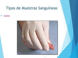 Tipos de Muestras Sanguíneas
 Capilar
 