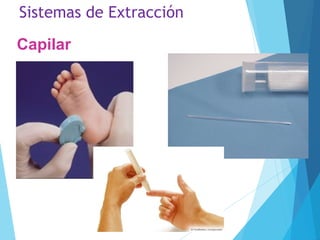 Sistemas de Extracción
Capilar
 