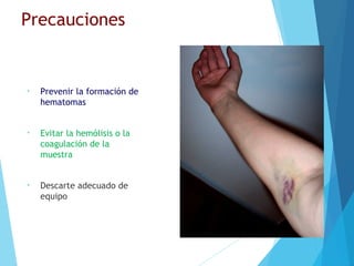 Precauciones
• Prevenir la formación de
hematomas
• Evitar la hemólisis o la
coagulación de la
muestra
• Descarte adecuado de
equipo
 