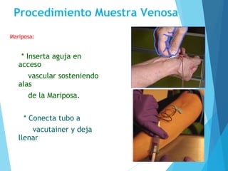 Procedimiento Muestra Venosa
Mariposa:
* Inserta aguja en
acceso
vascular sosteniendo
alas
de la Mariposa.
* Conecta tubo a
vacutainer y deja
llenar
 