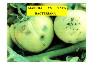 MANCHA VS PINTA
BACTERIANA
 