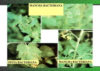 MANCHA BACTERIANA
MANCHA BACTERIANA
PINTA BACTERIANA
 