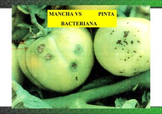 PINTA
MANCHA VS
BACTERIANA
 