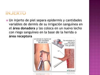    Un injerto de piel separa epidermis y cantidades
    variables de dermis de su irrigación sanguínea en
    el área donadora y las coloca en un nuevo lecho
    con riego sanguíneo en la base de la herida o
    área receptora
 