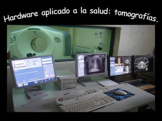 Hardware aplicado a la salud: tomografías. 