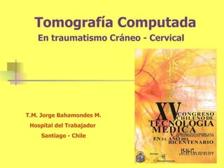 Tomografía Computada En traumatismo Cráneo -  Cervical T.M. Jorge Bahamondes M. Hospital del Trabajador  Santiago - Chile 