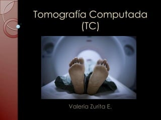 Tomografía Computada
(TC)
Valeria Zurita E.
 