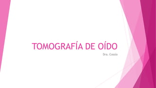 TOMOGRAFÍA DE OÍDO
Dra. Cossío
 