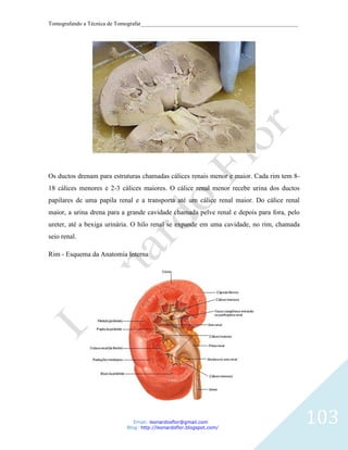 Tomografando a Técnica de Tomografar_______________________________________________________




Os ductos drenam para estruturas chamadas cálices renais menor e maior. Cada rim tem 8-
18 cálices menores e 2-3 cálices maiores. O cálice renal menor recebe urina dos ductos
papilares de uma papila renal e a transporta até um cálice renal maior. Do cálice renal
maior, a urina drena para a grande cavidade chamada pelve renal e depois para fora, pelo
ureter, até a bexiga urinária. O hilo renal se expande em uma cavidade, no rim, chamada
seio renal.

Rim - Esquema da Anatomia Interna




                               Email: leonardosflor@gmail.com
                            Blog: http://leonardoflor.blogspot.com/
                                                                                              103
 