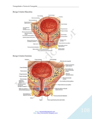 Tomografando a Técnica de Tomografar_______________________________________________________


Bexiga Urinária Masculina




Bexiga Urinária Feminina




                               Email: leonardosflor@gmail.com
                            Blog: http://leonardoflor.blogspot.com/
                                                                                              108
 