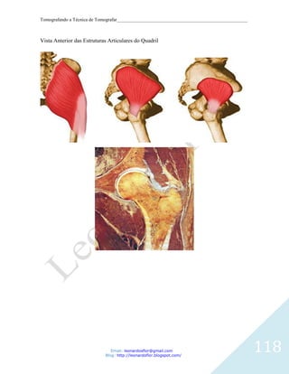 Tomografando a Técnica de Tomografar_______________________________________________________



Vista Anterior das Estruturas Articulares do Quadril




                               Email: leonardosflor@gmail.com
                            Blog: http://leonardoflor.blogspot.com/
                                                                                              118
 