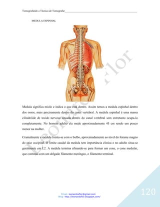 Tomografando a Técnica de Tomografar_______________________________________________________


       MEDULA ESPINHAL




Medula significa miolo e indica o que está dentro. Assim temos a medula espinhal dentro
dos ossos, mais precisamente dentro do canal vertebral. A medula espinhal é uma massa
cilindróide de tecido nervoso situada dentro do canal vertebral sem entretanto ocupa-lo
completamente. No homem adulto ela mede aproximadamente 45 cm sendo um pouco
menor na mulher.

Cranialmente a medula limita-se com o bulbo, aproximadamente ao nível do forame magno
do osso occipital. O limite caudal da medula tem importância clinica e no adulto situa-se
geralmente em L2. A medula termina afinando-se para formar um cone, o cone medular,
que continua com um delgado filamento meníngeo, o filamento terminal.




                               Email: leonardosflor@gmail.com
                            Blog: http://leonardoflor.blogspot.com/
                                                                                              120
 